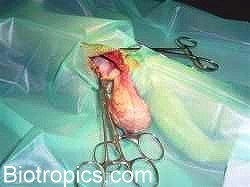 Urolith-OP